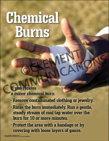 Chemical Burns Poster